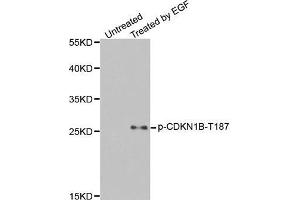 Western blot analysis of extracts from HeLa cells, using Phospho-CDKN1B-T187 antibody (ABIN2987947). (CDKN1B anticorps  (pThr187))