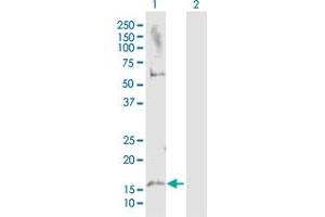Western Blot analysis of MAP1LC3A expression in transfected 293T cell line by MAP1LC3A MaxPab polyclonal antibody. (MAP1LC3A anticorps  (AA 1-121))