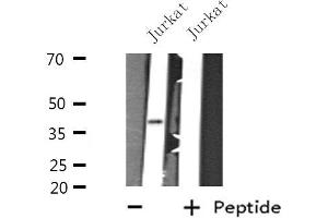 Western blot analysis of extracts from Jurkat cells, using GTF3A antibody. (GTF3A anticorps  (N-Term))