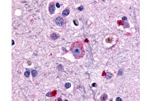 Anti-GRM1 / MGLUR1 antibody IHC of human brain, neurons and glia. (Metabotropic Glutamate Receptor 1 anticorps  (N-Term))