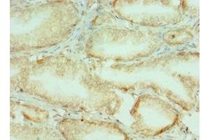 Immunohistochemistry of paraffin-embedded human prostate tissue using ABIN7148221 at dilution of 1:100 (COL1A1 anticorps  (AA 521-680))