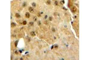IHC-P analysis of Brain tissue, with DAB staining. (PRNP anticorps  (AA 23-230))