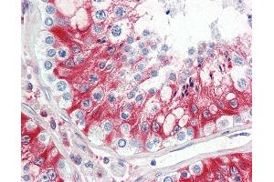 Anti-LHCGR / LHR / LH Receptor antibody IHC staining of human testis.