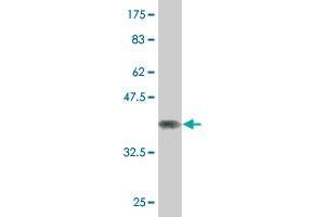 Western Blot detection against Immunogen (37. (NCOA4 anticorps  (AA 505-614))