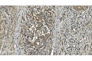 IHC analysis of RGS6 using anti-RGS6 antibody (ABIN7602326). (RGS6 anticorps  (AA 7-357))