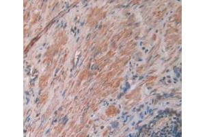 DAB staining on IHC-P; Samples: Human Prostate Gland Tissue (IL12A anticorps  (AA 23-219))