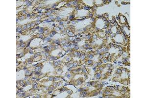 Immunohistochemistry of paraffin-embedded Mouse stomach using TRMT2A Polyclonal Antibody at dilution of 1:100 (40x lens). (TRMT2A anticorps)