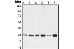 Western blot analysis of 14-3-3 gamma expression in A549 (A), A431 (B), K562 (C), NIH3T3 (D), PC12 (E), rat liver (F) whole cell lysates.