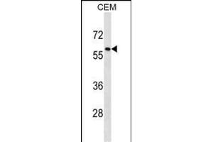TRIM58 Antibody (C-term) (ABIN1537364 and ABIN2850371) western blot analysis in CEM cell line lysates (35 μg/lane). (TRIM58 anticorps  (C-Term))