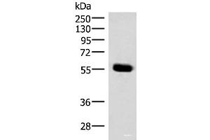 Western blot analysis of Mouse pancreas tissue lysate using IPPK Polyclonal Antibody at dilution of 1:350 (IPPK anticorps)
