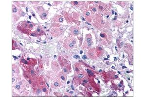 Human Adrenal: Formalin-Fixed, Paraffin-Embedded (FFPE) (TNIP3 anticorps  (C-Term))