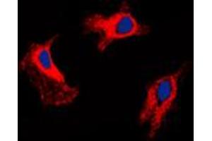 Immunofluorescent analysis of MMP9 staining in HuvEc cells.