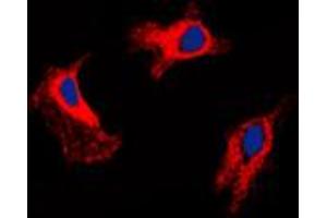 Immunofluorescent analysis of MMP9 staining in HuvEc cells. (MMP 9 anticorps  (C-Term))