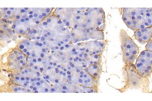 Detection of PIIINP in Mouse Pancreas Tissue using Polyclonal Antibody to Procollagen III N-Terminal Propeptide (PIIINP) (PIIINP anticorps  (AA 24-154))