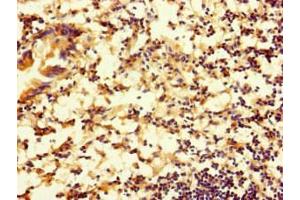 Immunohistochemistry of paraffin-embedded human appendix tissue using ABIN7167753 at dilution of 1:100 (RTN4IP1 anticorps  (AA 41-396))