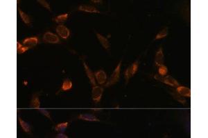 Immunofluorescence analysis of NIH-3T3 cells using USP30 Polyclonal Antibody at dilution of 1:100 (40x lens). (Usp30 anticorps)