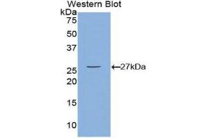 Western Blotting (WB) image for anti-Calcium/calmodulin-Dependent Protein Kinase II gamma (CAMK2G) (AA 75-281) antibody (ABIN3208166) (CAMKII gamma anticorps  (AA 75-281))
