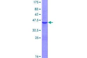 Image no. 1 for Peptidyl Prolyl Cis/Trans Isomerase NIMA Interacting 4 Protein (PIN4) (AA 1-156) protein (GST tag) (ABIN1315112)