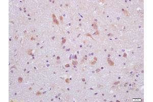 Formalin-fixed and paraffin embedded rat brain labeled with Anti-GLP-1 Polyclonal Antibody, Unconjugated (ABIN730003) at 1:200 followed by conjugation to the secondary antibody and DAB staining (GLP-1 anticorps  (AA 1-31))