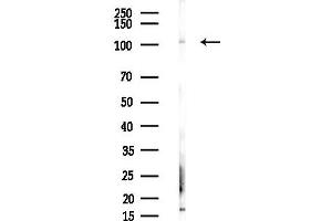 anti-Proteasome (Prosome, Macropain) 26S Subunit, Non-ATPase, 1 (PSMD1) (Internal Region) antibody