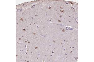 Immunohistochemical staining (Formalin-fixed paraffin-embedded sections) of human cerebral cortex shows moderate cytoplasmic and nucleolar positivity in neuronal cells with PNMA2 polyclonal antibody . (PNMA2 anticorps  (AA 58-206))