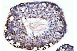 anti-Kinesin Family Member C1 (KIFC1) (AA 1-673) antibody