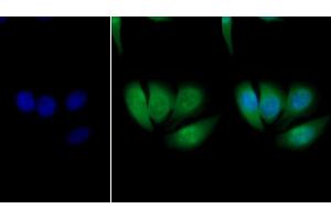 Detection of GSTp in Human HepG2 cell using Polyclonal Antibody to Glutathione S Transferase Pi (GSTp)
