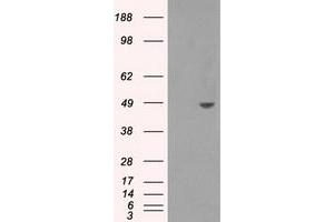Western Blotting (WB) image for anti-Sorbitol Dehydrogenase (SORD) antibody (ABIN1501077) (SORD anticorps)