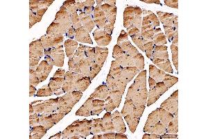 IHC analysis of ATP2A1 using anti-ATP2A1 antibody (ABIN3043792).