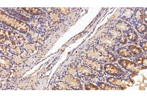 Detection of ANG in Rat Colon Tissue using Polyclonal Antibody to Angiogenin (ANG)