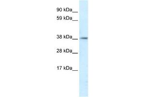 WB Suggested Anti-PSMD11 Antibody Titration:  5. (PSMD11 anticorps  (C-Term))