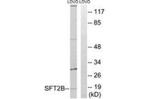 Western blot analysis of extracts from LOVO cells, using SFT2B Antibody.