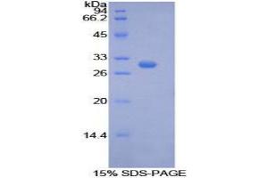 SDS-PAGE (SDS) image for phosphoenolpyruvate Carboxykinase 1 (Soluble) (PCK1) (AA 311-558) protein (His tag) (ABIN1877500)