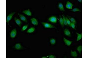 Immunofluorescent analysis of A549 cells using ABIN7159356 at dilution of 1:100 and Alexa Fluor 488-congugated AffiniPure Goat Anti-Rabbit IgG(H+L)