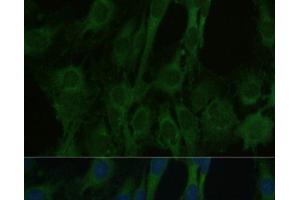 Immunofluorescence analysis of C6 cells using FABP7 Polyclonal Antibody at dilution of 1:100. (FABP7 anticorps)