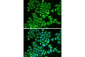 Immunofluorescence analysis of U2OS cells using PDE1B antibody. (PDE1B anticorps  (AA 190-536))