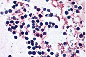 ABIN570839 (5µg/ml) staining of paraffin embedded Human peripheral blood leukocytes. (NLRP3 anticorps  (N-Term))