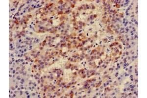 Immunohistochemistry of paraffin-embedded human pancreatic tissue using ABIN7156336 at dilution of 1:100 (IRS2 anticorps  (AA 766-1001))