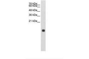 Image no. 1 for anti-Cystatin S (CST4) (N-Term) antibody (ABIN203409) (CST4 anticorps  (N-Term))