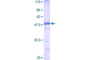 Image no. 1 for CASP2 and RIPK1 Domain Containing Adaptor with Death Domain (CRADD) (AA 1-199) protein (GST tag) (ABIN1350268)