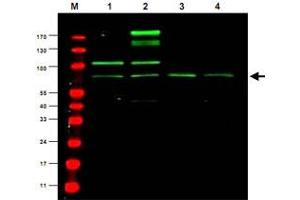 Western blot using Rreb1 polyclonal antibody  shows detection ofa predominant band believed to be Rreb1 invarious cell lysates (1 - HEK293, 2 - RFP-Rreb transfected HEK293, 3 - M460 and 4 - T1165). (RREB1 anticorps)
