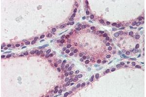 Anti-ESYT1 / FAM62A antibody  ABIN1048589 IHC staining of human thyroid.