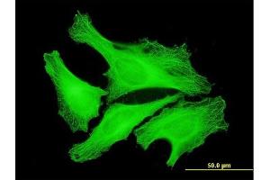 Immunofluorescence of monoclonal antibody to TUBA4A on HeLa cell. (TUBA4A anticorps  (AA 1-448))