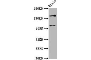Western Blot Positive WB detected in: Rat brain tissue All lanes: SOS1 antibody at 4.