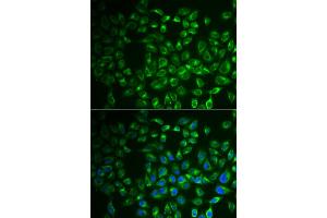 Immunofluorescence analysis of A549 cells using FABP6 antibody. (FABP6 anticorps)