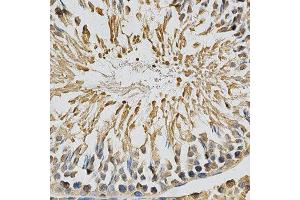 Immunohistochemistry (IHC) image for anti-Cytochrome P450, Family 1, Subfamily A, Polypeptide 1 (CYP1A1) (AA 200-460) antibody (ABIN3023076)