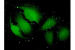 Immunofluorescence of monoclonal antibody to TXNDC9 on HeLa cell.