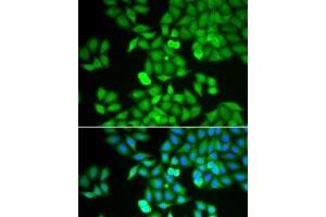Immunofluorescence analysis of HeLa cells using ARHGDIA Polyclonal Antibody (ARHGDIA anticorps)