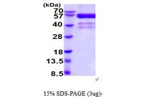 SDS-PAGE (SDS) image for Hepatitis A Virus Cellular Receptor 2 (TIM 3) (AA 22-202) protein (hIgG-His-tag) (ABIN5854622) (TIM3 Protein (AA 22-202) (hIgG-His-tag))