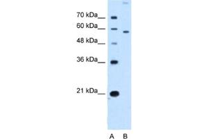 Western Blotting (WB) image for anti-Solute Carrier Family 22 (Organic Cation Transporter), Member 2 (SLC22A2) antibody (ABIN2462742) (SLC22A2 anticorps)